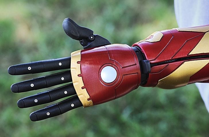 Boy has 'Iron Man' arm