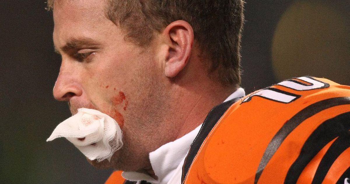 Kevin Huber, healthy jaw face Steelers again