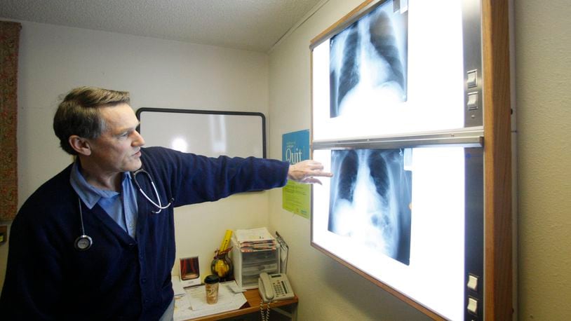 FILE - Dr. Brad Black with the Center for Asbestos Related Disease health clinic is shown looking at X-rays, Feb. 18, 2010, in Libby, Mont. (AP Photo/Rick Bowmer, File)