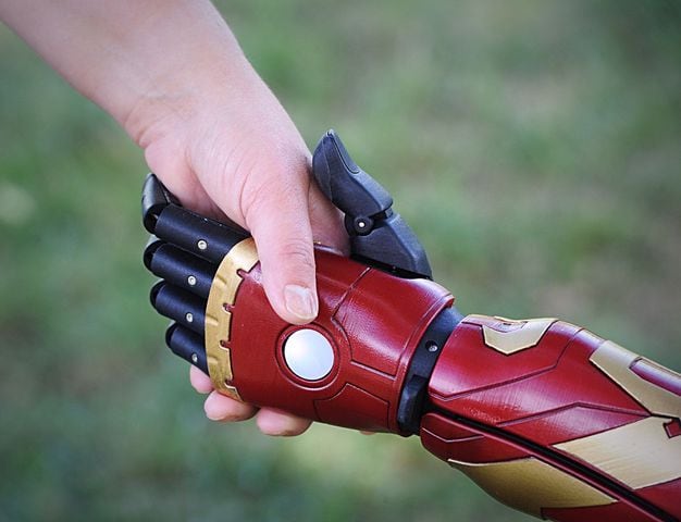 Boy has 'Iron Man' arm