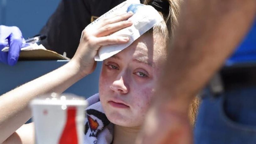 Kaitlyn Salazar applies an ice pack to her head after being struck by a foul ball Sunday at Dodger Stadium.