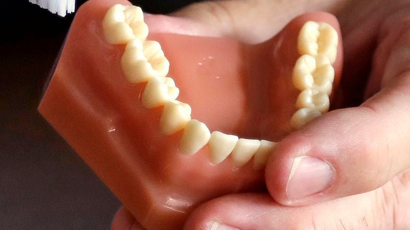 FILE - A dentist holds a model of teeth in Seattle. (AP Photo/Elaine Thompson, File)