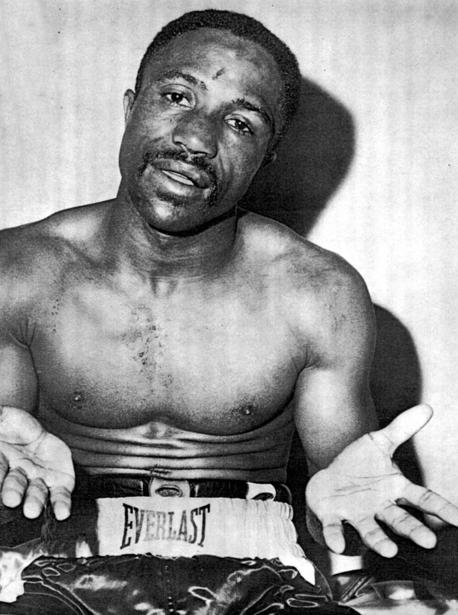 Boxer Davey Moore talks to press after his last fight in this file photo taken March 21, 1963. He collapsed soon after and died in a Los Angeles hospital.