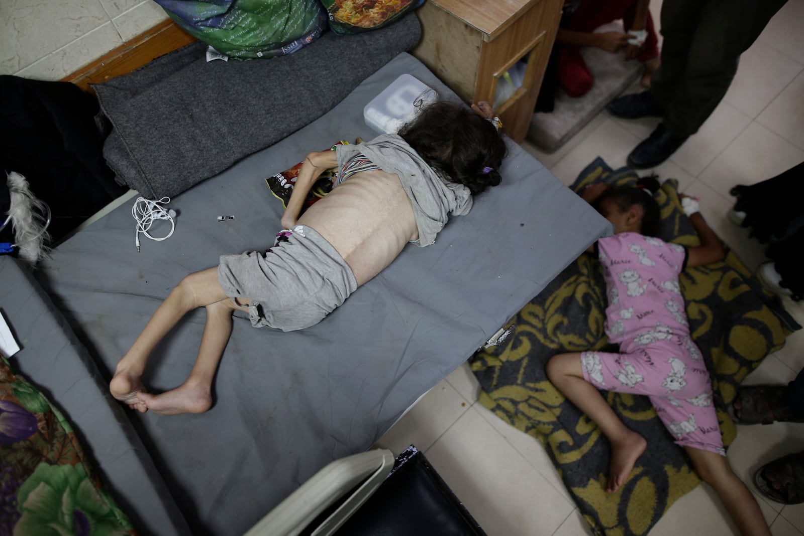 FILE - Hana Al-Rai, 3, left, who suffers from diabetes, a weakened immune system and malnutrition, rests at Al-Aqsa Martyrs Hospital in Deir al-Balah in the central Gaza Strip, where she is receiving treatment, on June 1, 2024. (AP Photo/Jehad Alshrafi, File)