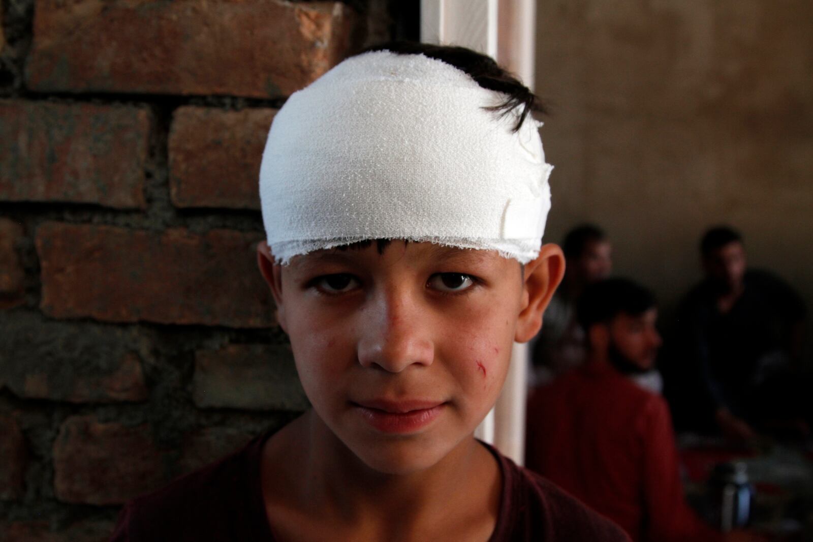 A stands at his home after being injured in an explosion, in Kabul, Afghanistan, Wednesday, Sept. 9, 2020. Afghanistan’s Interior Ministry said the bombing in Kabul targeting the convoy of the country’s first vice president killed many people and wounded more than a dozen others, including several of the vice president’s bodyguards. First Vice President Amrullah Saleh suffered minor burns in the attack on Wednesday morning. (AP Photo/Rahmat Gul)