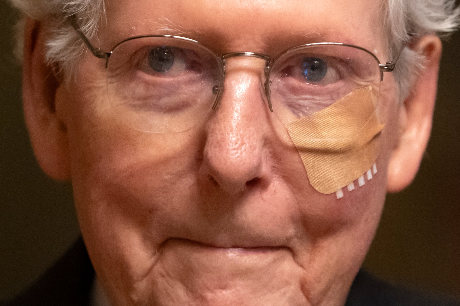 FILE - Senate Minority Leader Mitch McConnell of Ky. wears a bandage on his face as he walks to cast a vote on the Senate floor after falling during a luncheon on Capitol Hill, Dec. 10, 2024, in Washington. (AP Photo/Mark Schiefelbein, File)