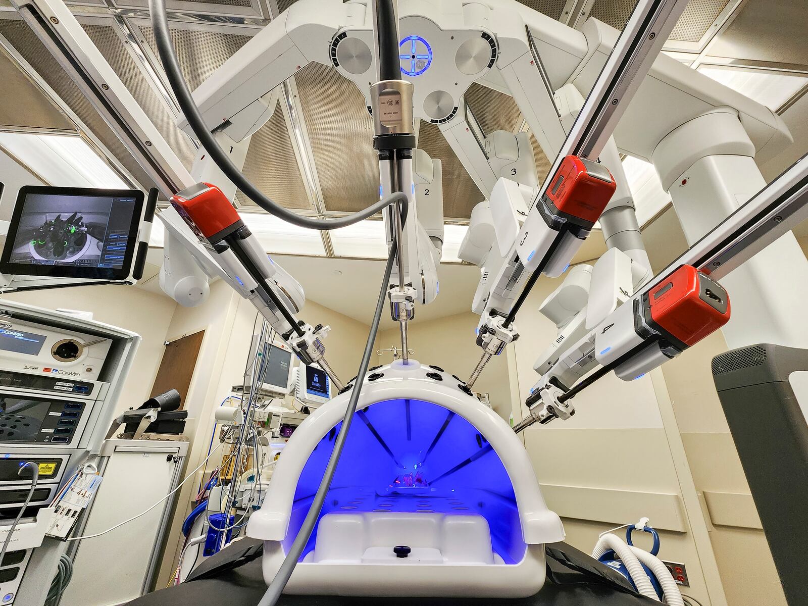 Kettering Health Hamilton has been using their Davinci XI surgical robot. The hospital has multiple doctors, nurses and support staff trained in using the machine for less invasive surgeries with faster recovery time. NICK GRAHAM/STAFF