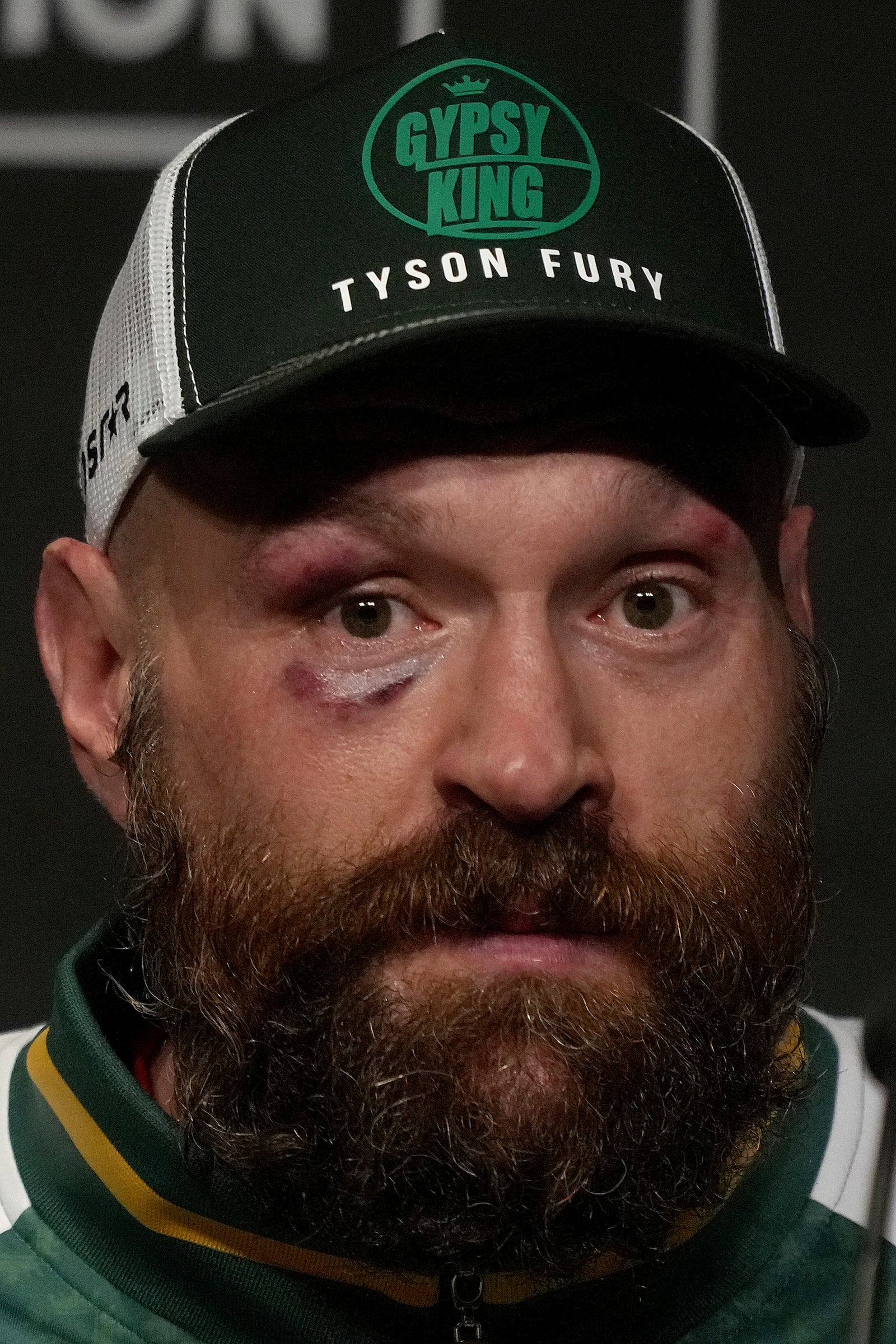 Britain's boxer Tyson Fury speaks at a press conference after loosing his fight against Ukraine's boxer Oleksandr Usyk for the WBA, WBO, and WBC heavyweight title in Riyadh, Saudi Arabia, Sunday, Dec. 22, 2024.(AP Photo/Frank Augstein)