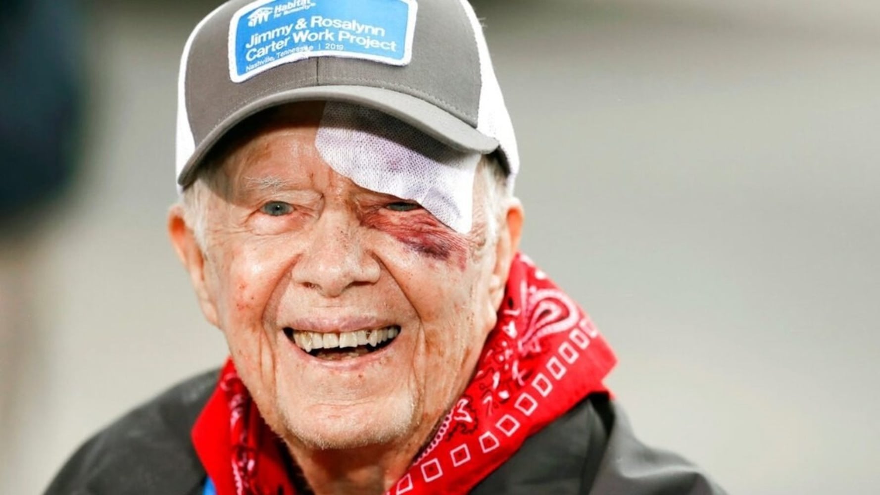 Jimmy Carter's fall: What happens when you break your pelvis?