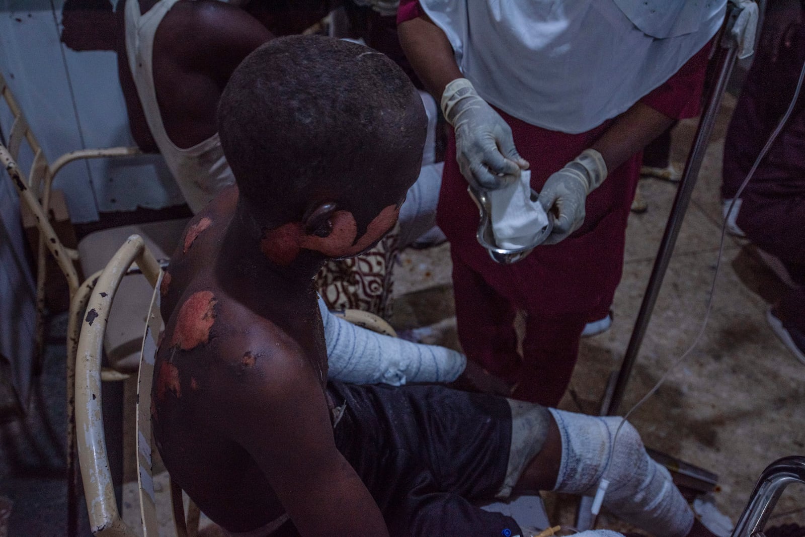 A victim of a tanker explosion from Majiya town receive treatment at the Aminu Kano teaching hospital in Kano Nigeria, Wednesday, Oct. 16, 2024. (AP Photo/Sani Maikatanga)