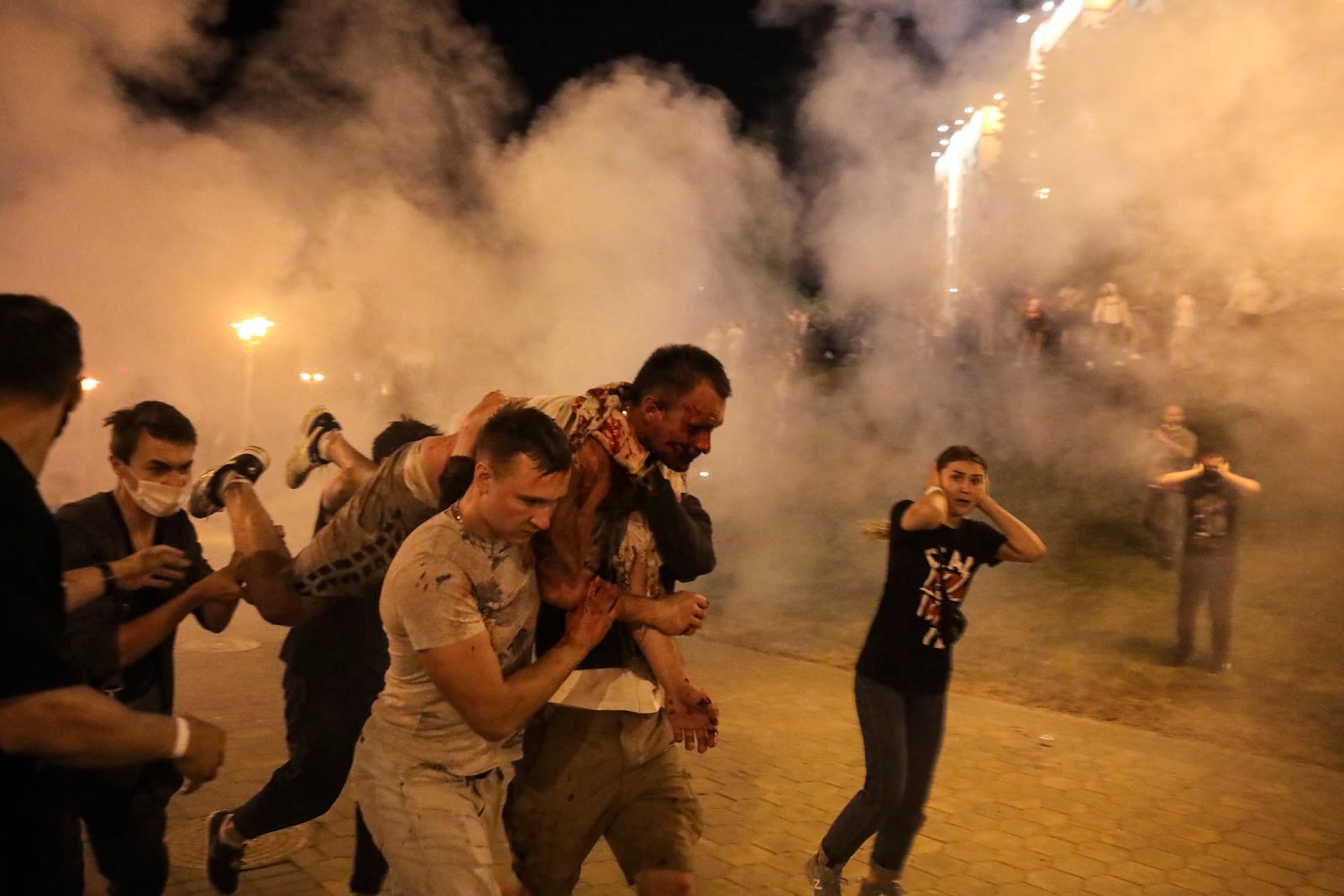 FILE - Protesters carry a man injured during clashes with police amid anti-government demonstrations in Minsk, Belarus, Aug. 10, 2020. (AP Photo, File)