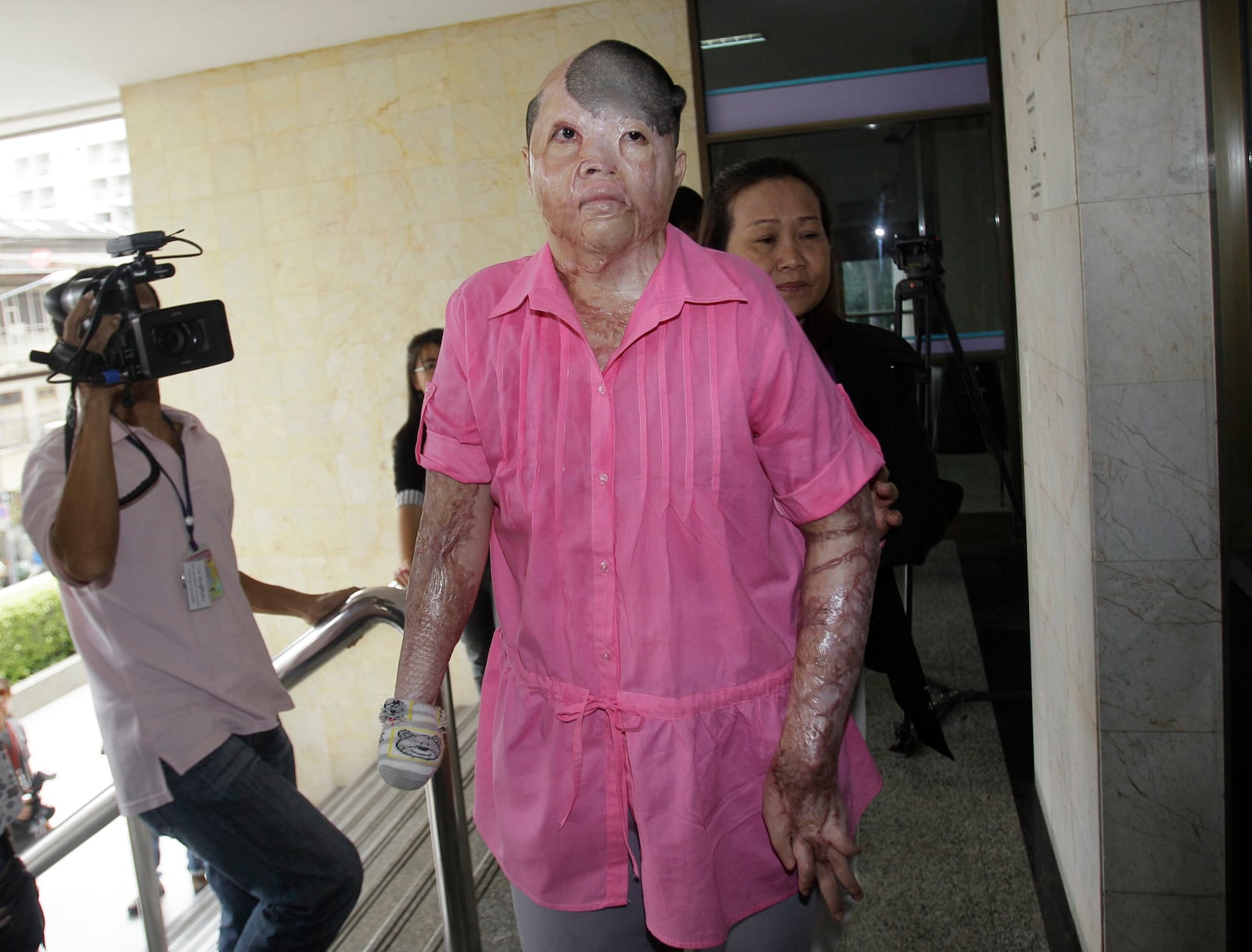 FILE -Victim of nightclub fire Rattana Saelim arrives at'the Bangkok Criminal Court in Bangkok, Thailand, on Tuesday, Sept. 20, 2011. (AP Photo/Sakchai Lalit, File)