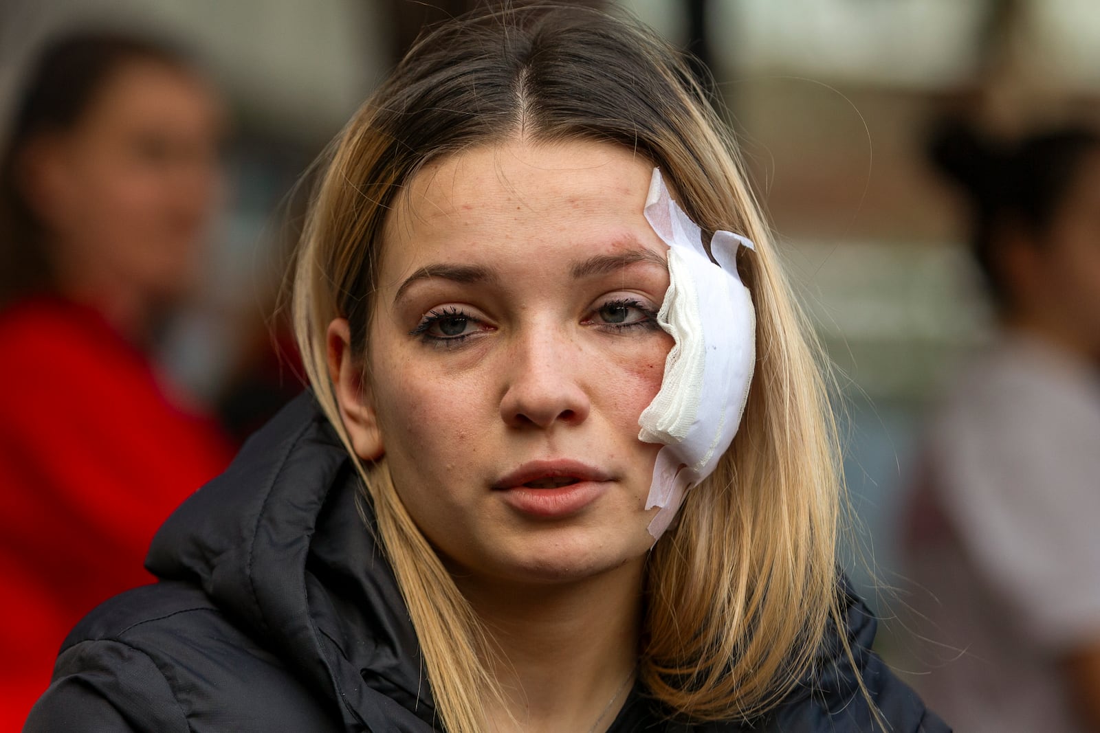 Maria Taseva, a 19 years-old survivor, who said her sister died in the fire, sits outside a hospital in the town of Kocani, North Macedonia, Sunday, March 16, 2025, following a massive fire in the nightclub early Sunday. (AP Photo/Visar Kryeziu)