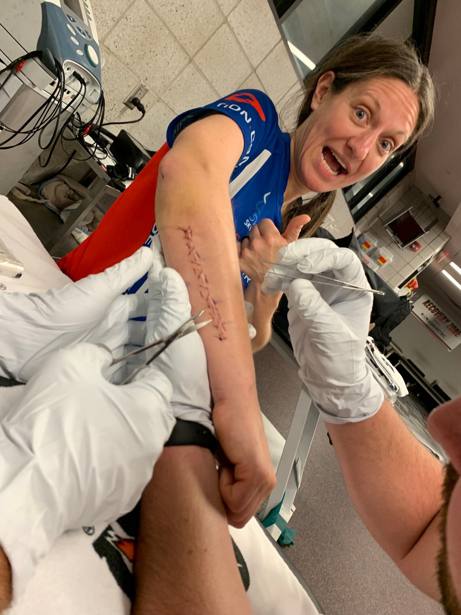 Condrey's injuries included an arm fracture, which was repaired immediately. Long term, though, she was not gaining back full range of motion due to a compressed disk in her spine. She is shown getting stitches removed from her arm.