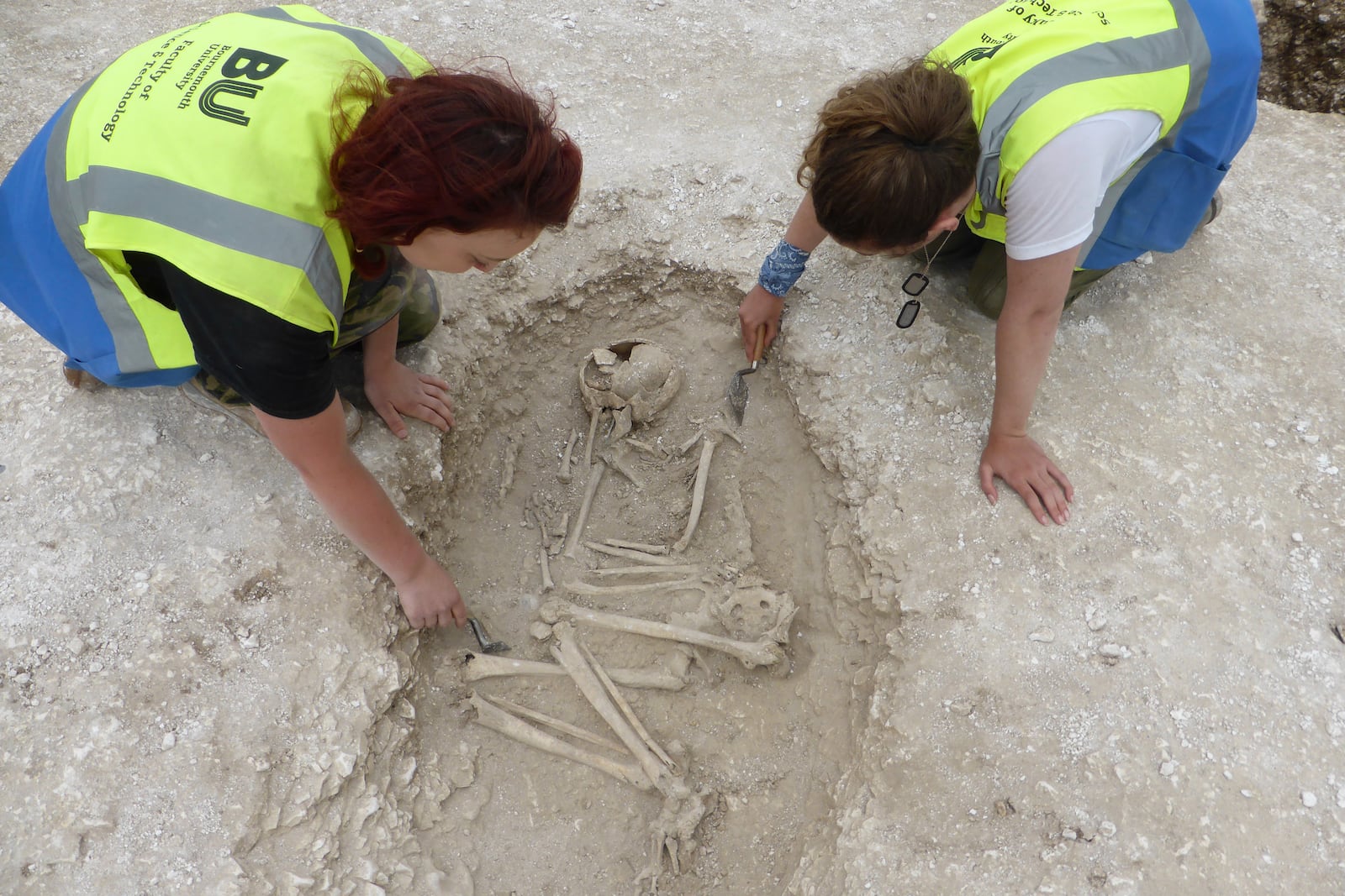 This photo provided by Bournemouth University in January 2025 shows burials being investigated at an Iron Age Celtic cemetery as part of the Durotriges tribe project dig in Dorset, southwest England. (Bournemouth University via AP)