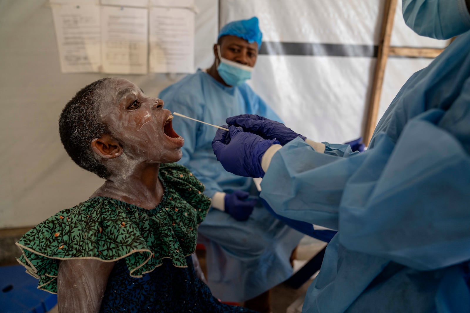 FILE - A health worker takes a saliva sample from Lucie Habimana, 13, a mpox patient, at a treatment centre in Munigi, eastern Congo, Aug. 16, 2024. (AP Photo/Moses Sawasawa, File)