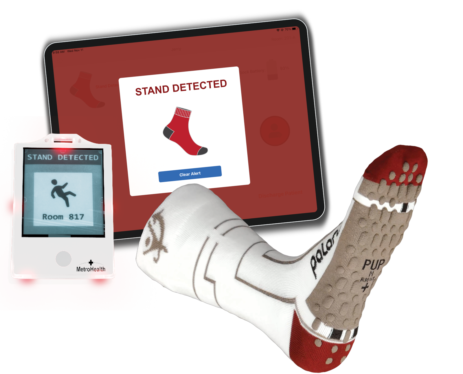 Palarum PUP (Patient is Up) SmartSocks is wearable technology to prevent patient falls in hospital rooms and can alert nurses at their station or on their smart badges. CONTRIBUTED/PALARUM, LLC