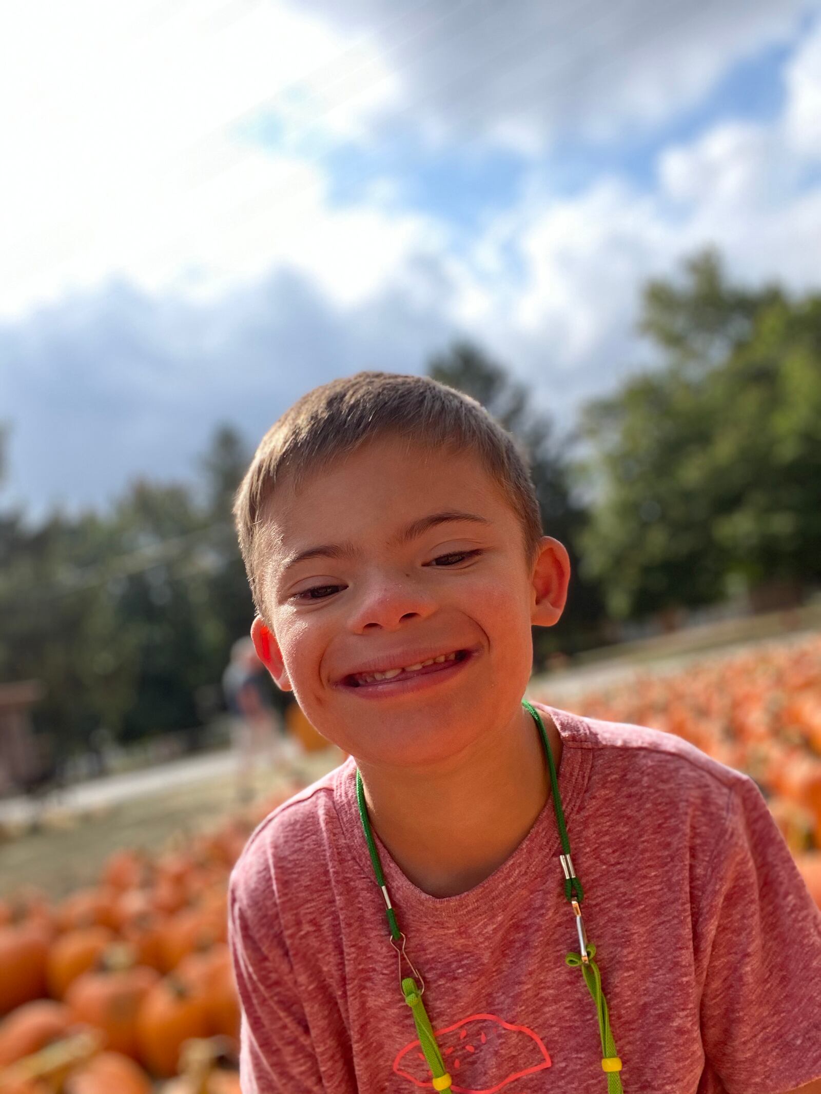 George Holzberg, 7, has Down Syndrome and needs the help of a professional service dog to both to remind him to focus in school and help keep him safe should he wander. His family recently raised $18,000 in just 24 hours, thanks to the generosity of the community, family, co workers and friends.