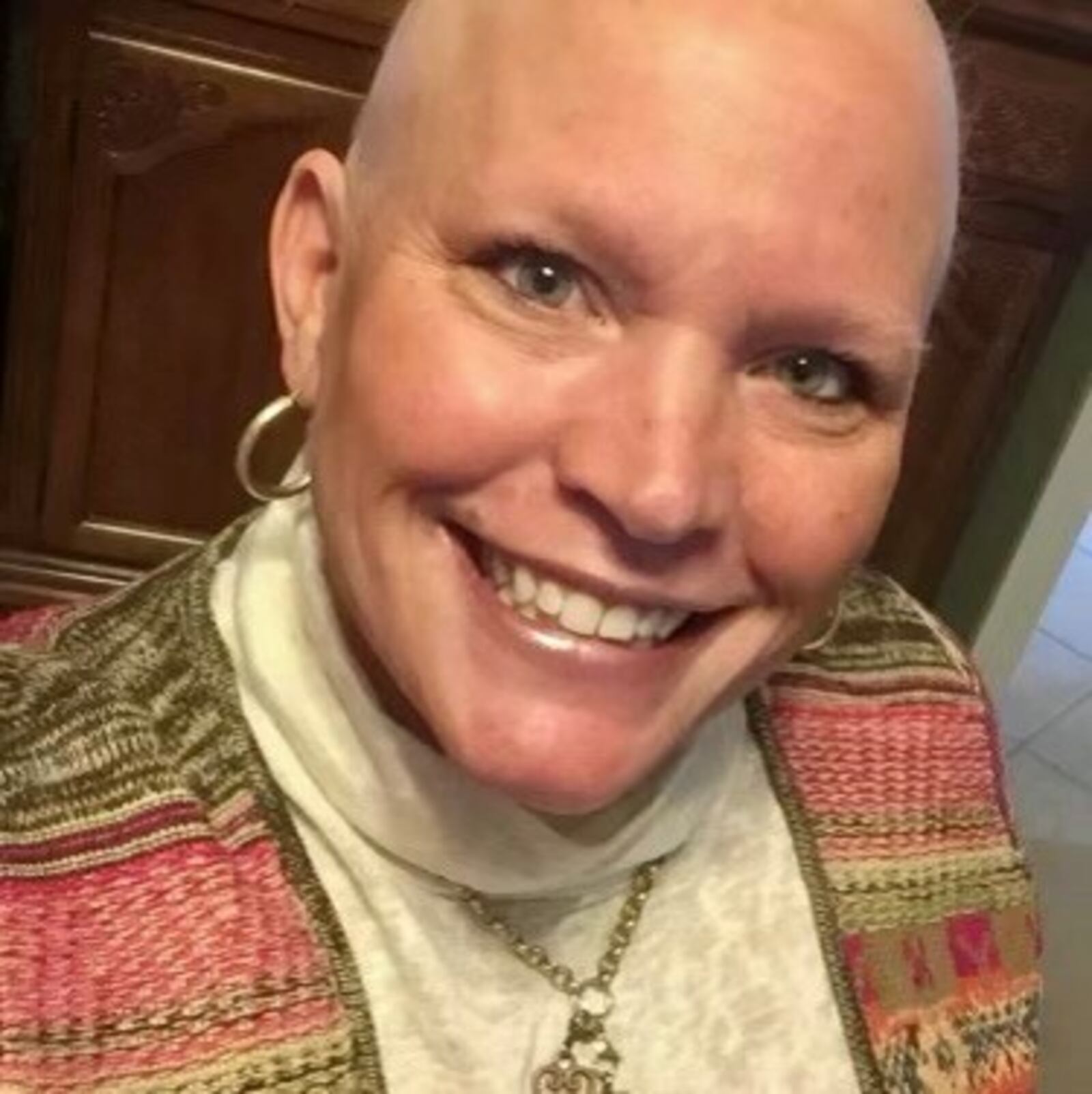 When Susan Boesch-Trangenstein started chemotherapy for breast cancer, she lost her hair. Contributed