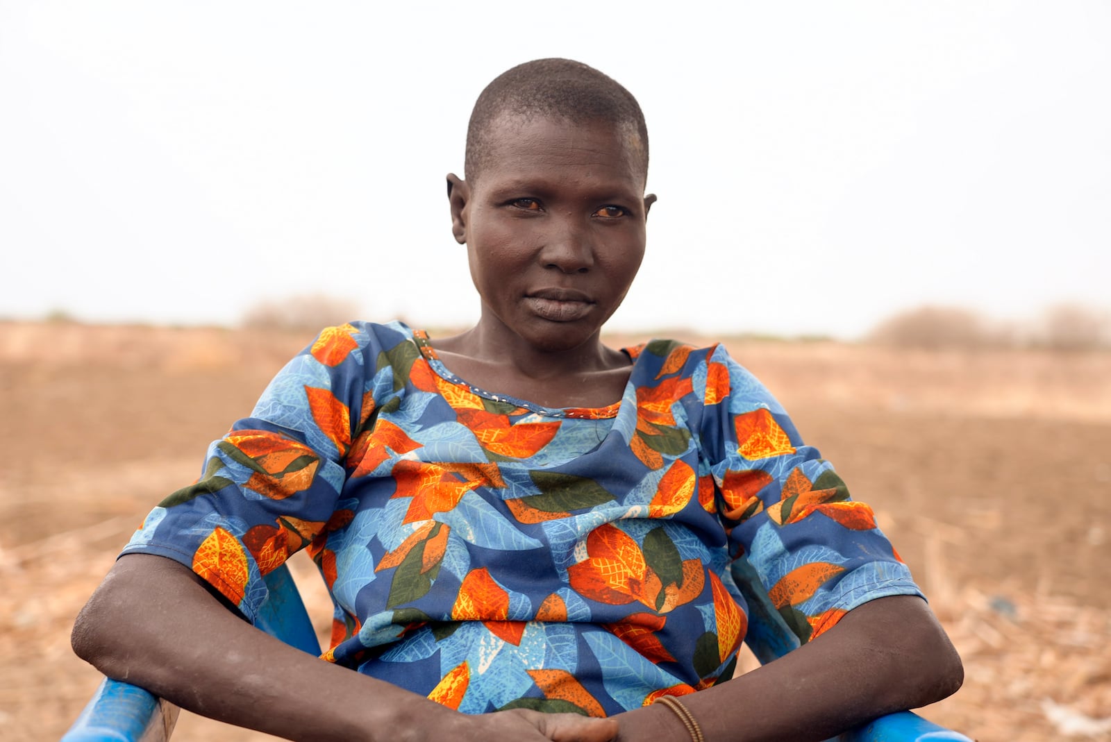 Nyingong Aguek, who contracted Guinea worm after she and her two sons drank swampy water while traveling in 2022, poses in Jarweng, South Sudan, on May 13, 2023. (AP Photo/Sam Mednick)