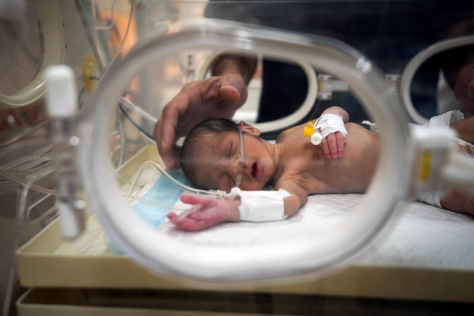 Ali al-Batran, a 20-day-old infant, lies in the intensive care unit with hypothermia at Al-Aqsa Martyrs Hospital in Deir al-Balah, central Gaza, Sunday, Dec. 29, 2024. His twin brother, Jomaa, has died, as local health officials report at least three other infant deaths from the cold in recent weeks. (AP Photo/Abdel Kareem Hana)