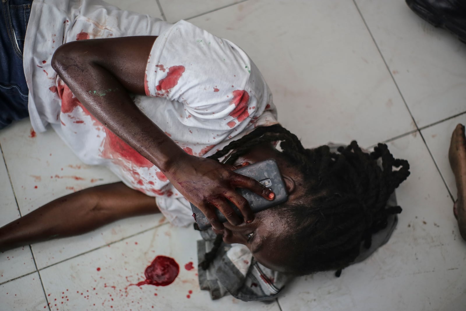 A wounded journalist talks on the phone after being shot by armed gangs at the General Hospital in Port-au-Prince, Haiti, Tuesday, Dec. 24, 2024. (AP Photo/Jean Feguens Regala)