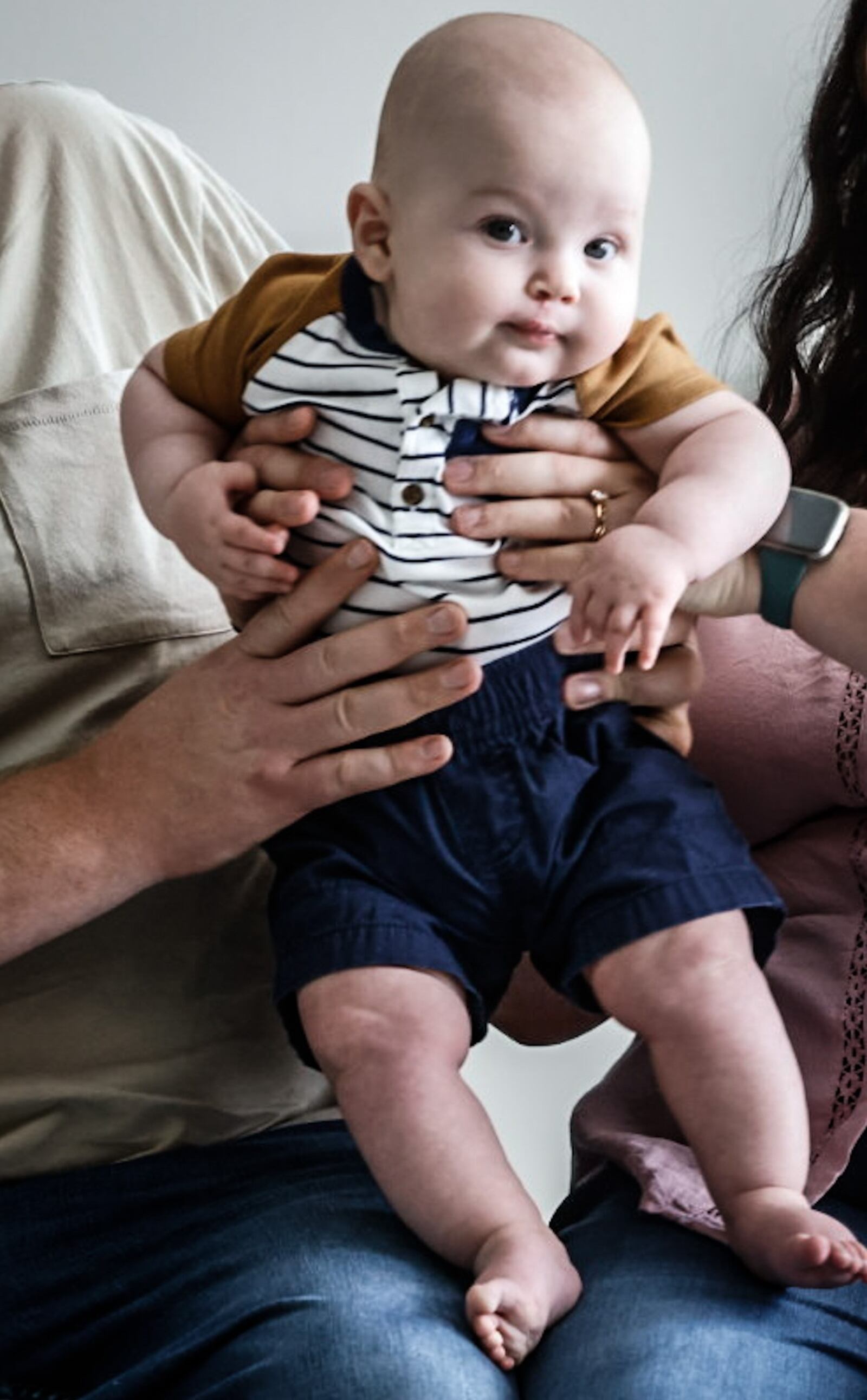 Five-month-old Case Lauf was born with a cleft lip and had a successful surgery at Shriners Children's of Ohio in Dayton. JIM NOELKER/STAFF