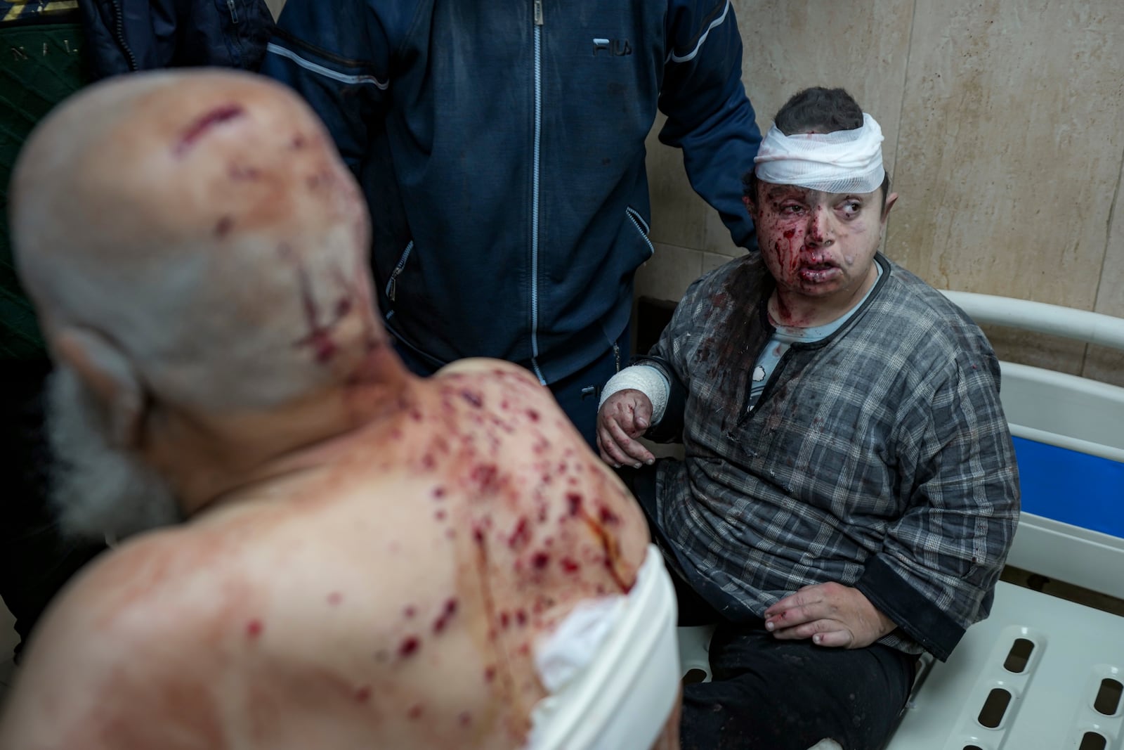 Palestinians, wounded in the Israeli bombardment of the Gaza Strip, receive treatment at the Al-Aqsa Hospital in Deir al-Balah, Monday, Dec. 16, 2024. (AP Photo/Abdel Kareem Hana)