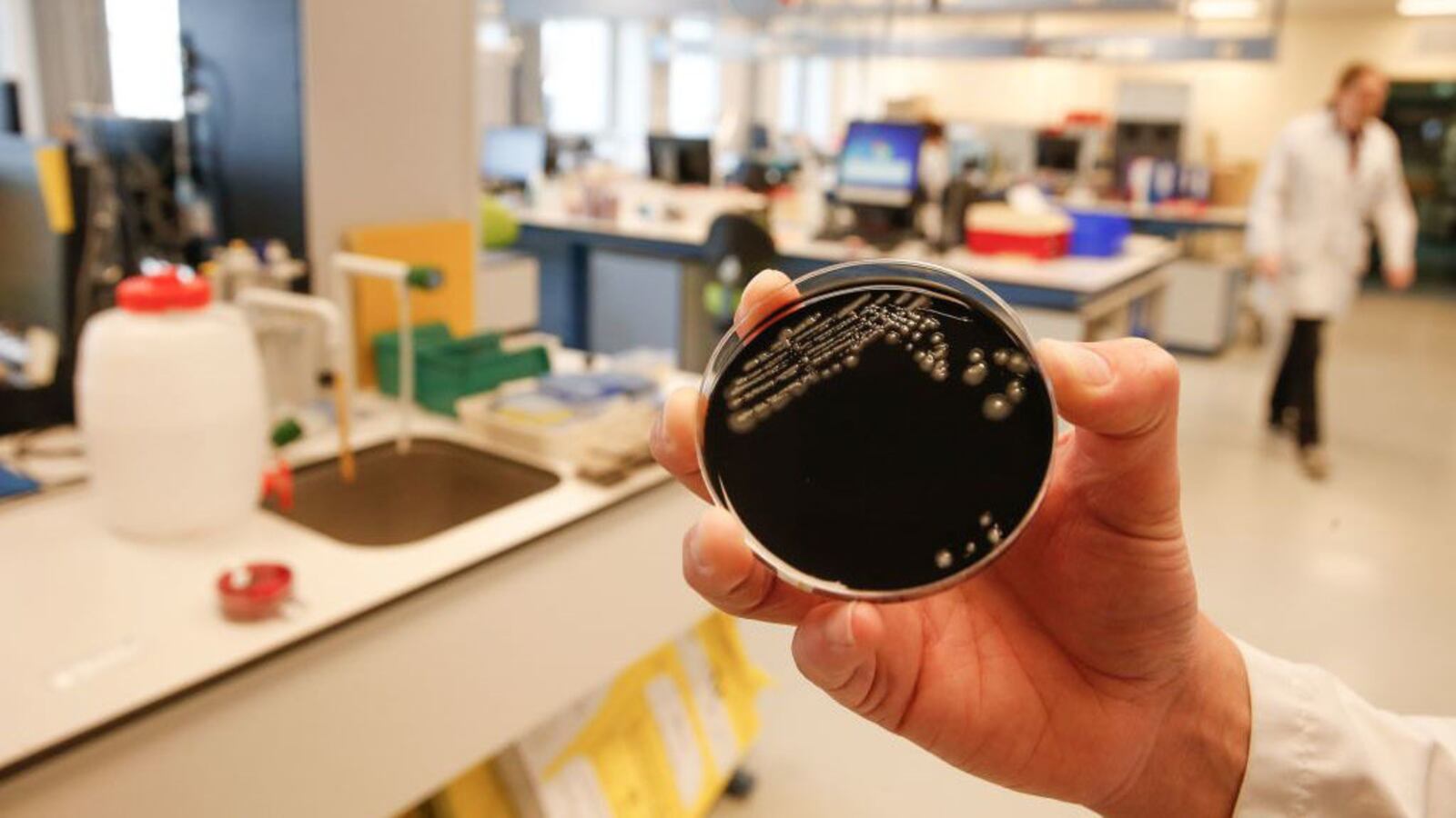 A photo of a culture of the Legionella pneumophila bacteria. 