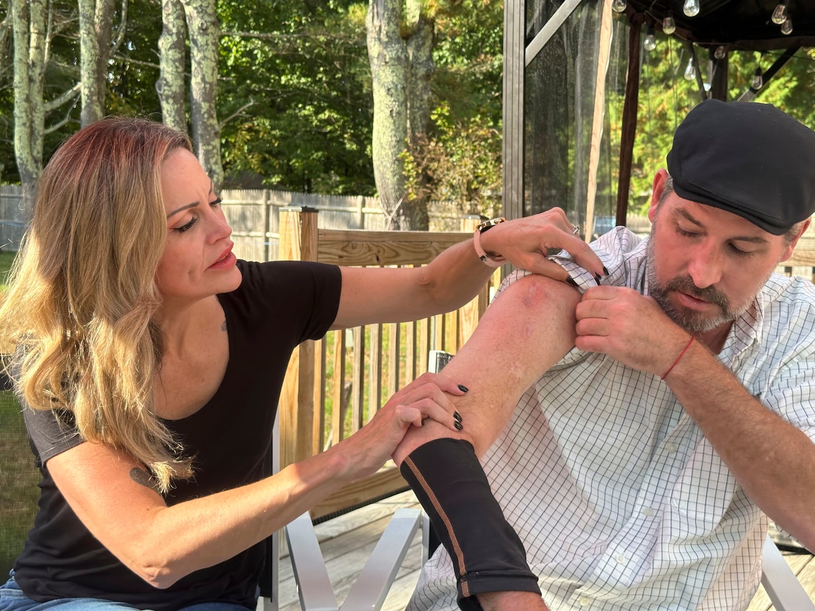 Lewiston mass shooting survivor Ben Dyer (right) and fiancée Keela Smith examine Dyer's injuries from the 2023 massacre and talk about their plans for the future on Wednesday, Oct. 3, 2024 in Auburn, Maine. (AP Photo/Nick Perry)