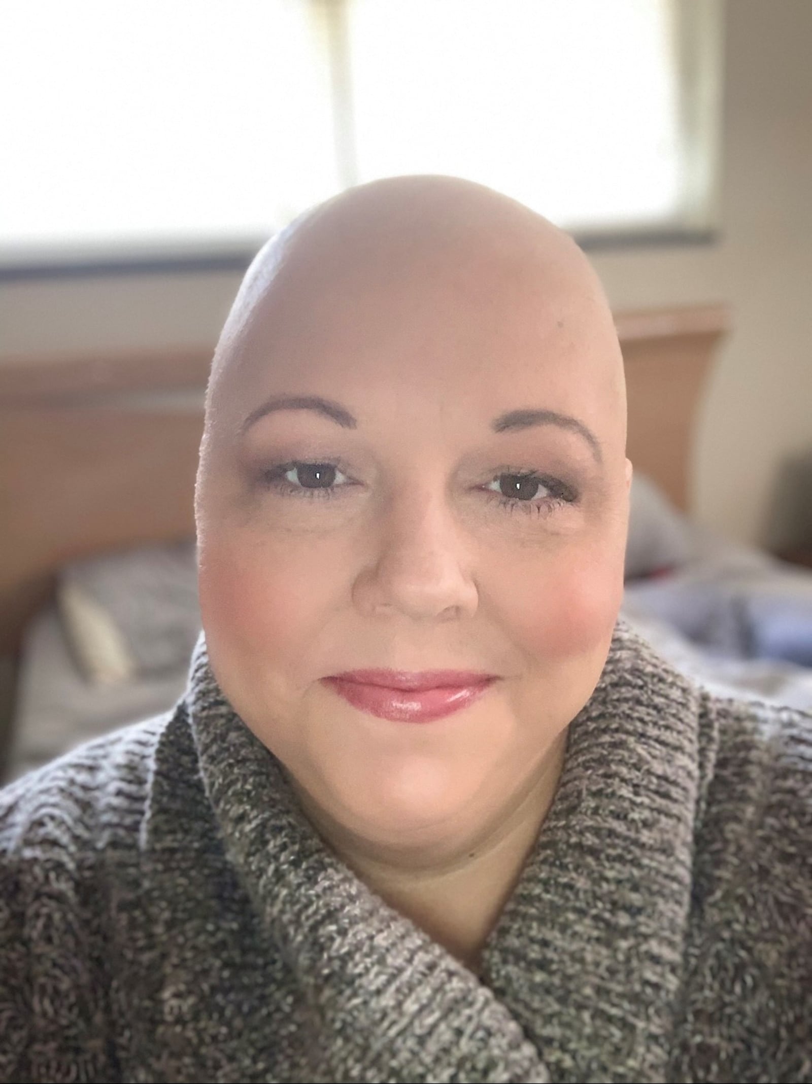 "The hardest side effects were losing my hair and the nail damage," said breast cancer survivor Michelle Davis. Fourteen days after her first chemo treatment, Davis said her hair started falling out in clumps. CONTRIBUTED