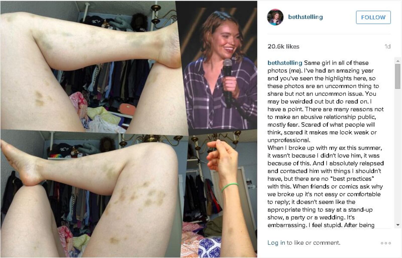 Los Angeles-based comedian Beth Stelling, an Oakwood native and Miami University graduate, has publicly revealed a past abusive relationship. Instagram photo