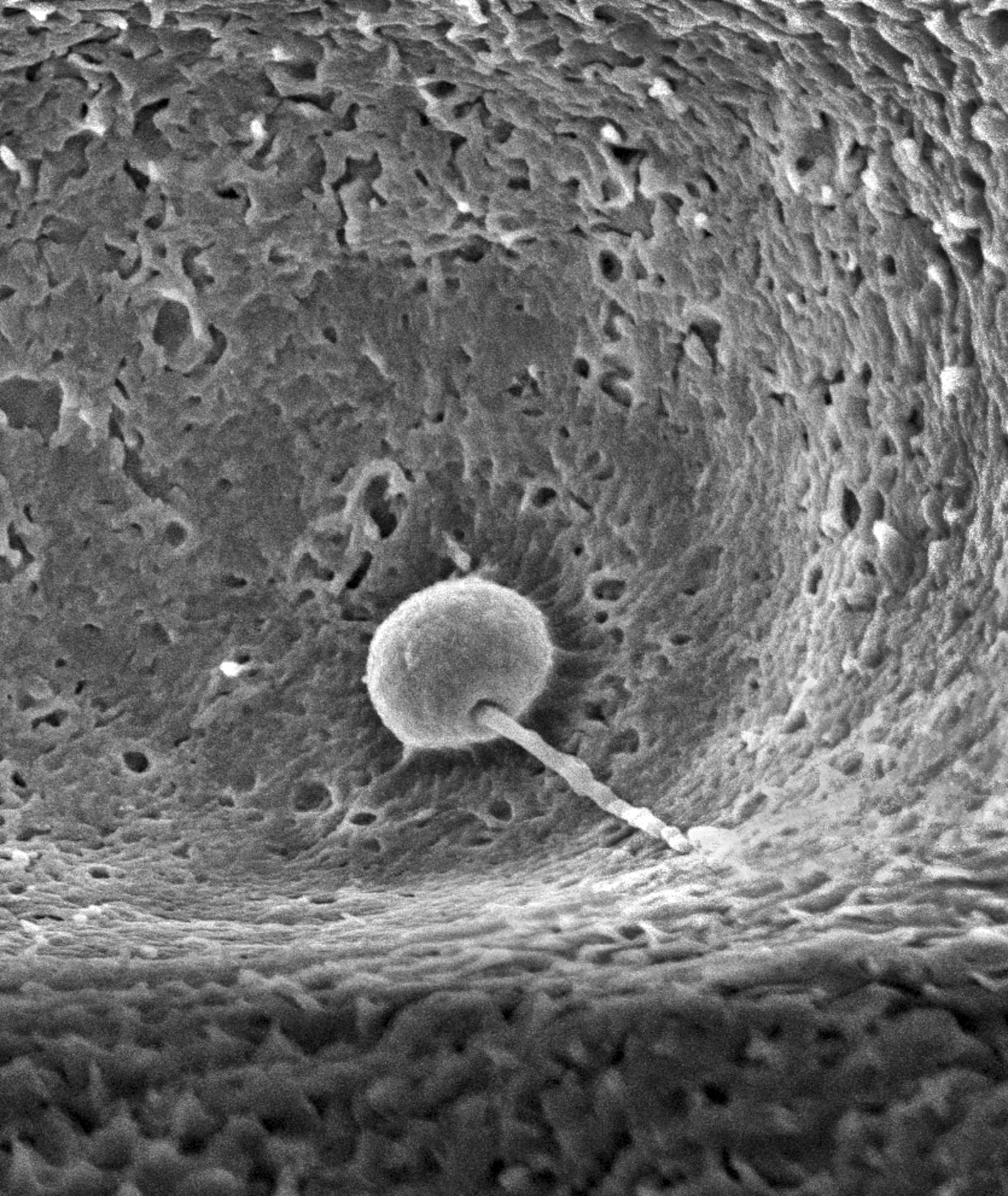 This electron microscope image provided by the Research Institute of Molecular Pathology in October 2024, shows a zebrafish sperm bound to the sperm-entry site of a zebrafish egg. (IMP via AP)